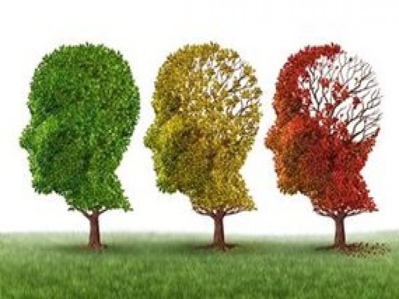 Alimlər Alzheimer xəstəliyinin inkişafını ləngidən bir yol tapmışdır